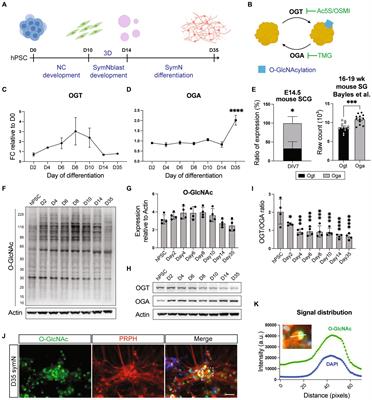 O-GlcNAcylation is crucial for sympathetic neuron development, maintenance, functionality and contributes to peripheral neuropathy